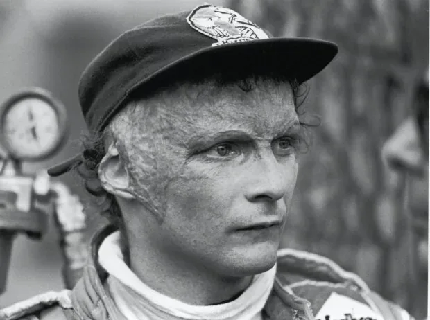 Niki Lauda sits in a Formula 1 car again shortly after his fire accident